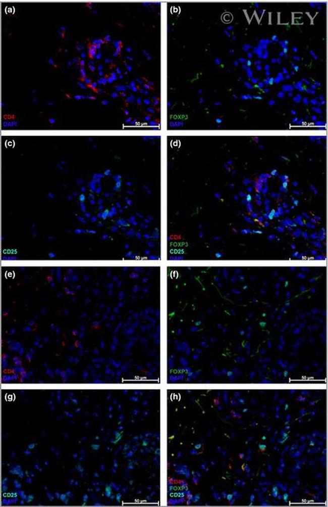 FOXP3 Antibody in Immunohistochemistry (IHC)