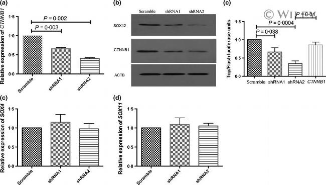 beta Catenin Antibody in Western Blot (WB)