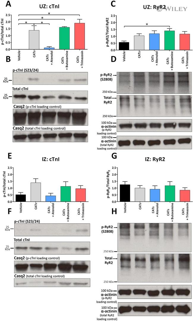 Calsequestrin Antibody in Western Blot (WB)