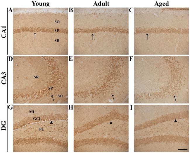 Nurr1 Antibody in Immunohistochemistry (IHC)