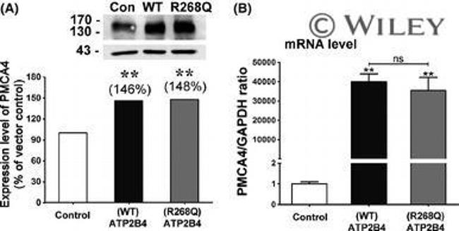 PMCA4 ATPase Antibody in Western Blot (WB)