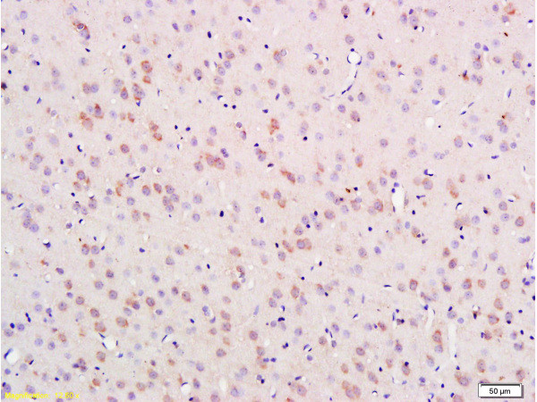 Nestin Antibody in Immunohistochemistry (Paraffin) (IHC (P))