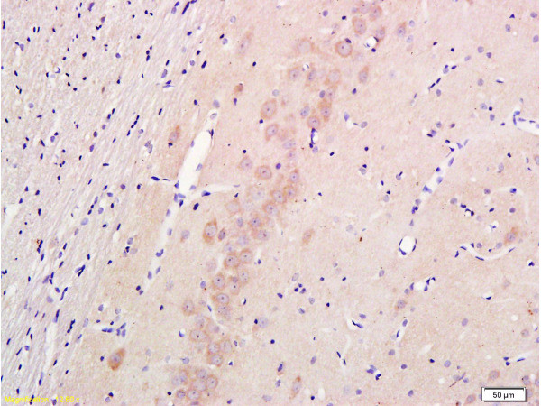 Nestin Antibody in Immunohistochemistry (Paraffin) (IHC (P))