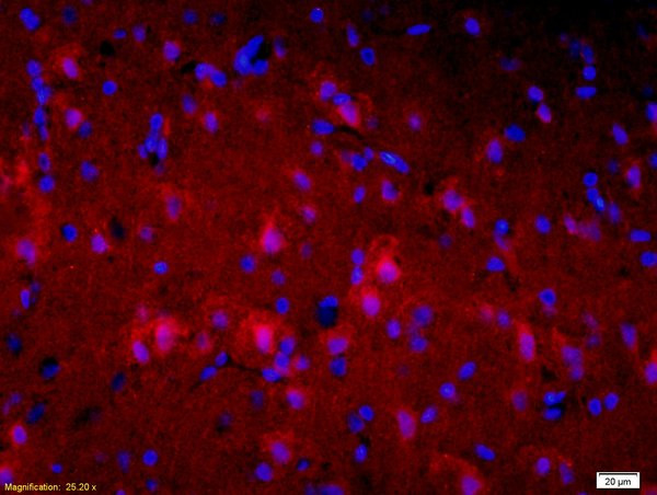 alpha + beta Synuclein Antibody in Immunohistochemistry (Paraffin) (IHC (P))