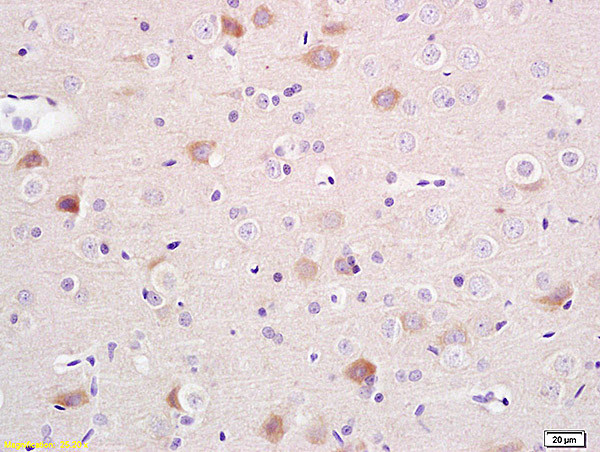 alpha + beta Synuclein Antibody in Immunohistochemistry (Paraffin) (IHC (P))