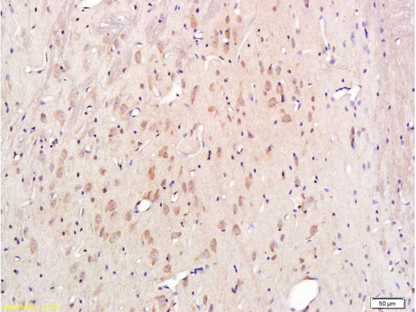 Cytochrome C Antibody in Immunohistochemistry (Paraffin) (IHC (P))