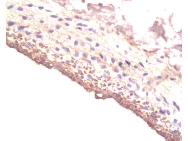 IGF 1 Antibody in Immunohistochemistry (Paraffin) (IHC (P))