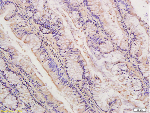 IDE Antibody in Immunohistochemistry (Paraffin) (IHC (P))