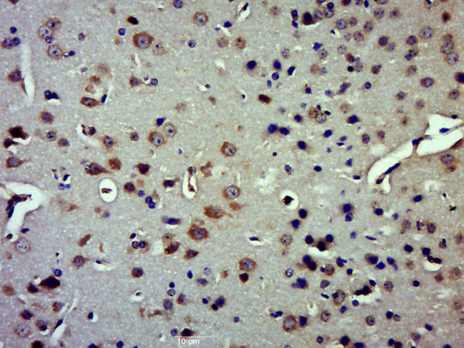 IDE Antibody in Immunohistochemistry (Paraffin) (IHC (P))