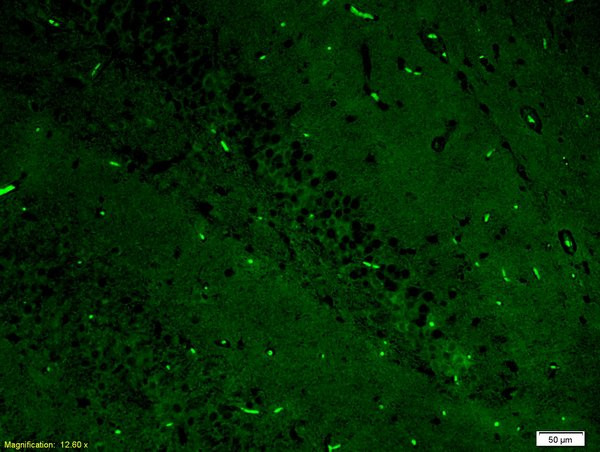 ERK1/ERK2 Antibody in Immunohistochemistry (Paraffin) (IHC (P))