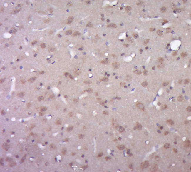 Presenilin 1 Antibody in Immunohistochemistry (Paraffin) (IHC (P))