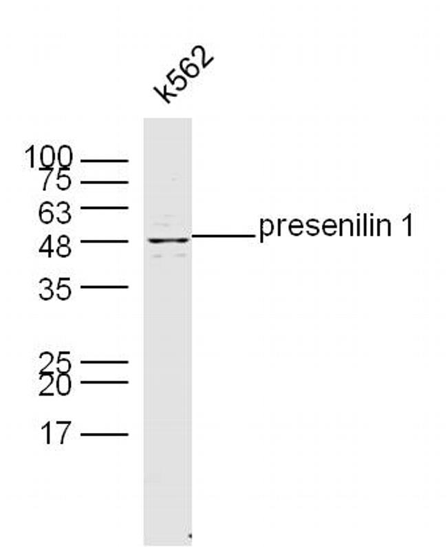 Presenilin 1 Antibody in Western Blot (WB)