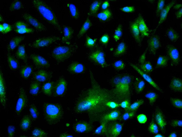 GSK-3 Beta CT Antibody in Immunocytochemistry (ICC/IF)