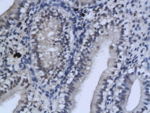 GSK-3 Beta CT Antibody in Immunohistochemistry (Paraffin) (IHC (P))