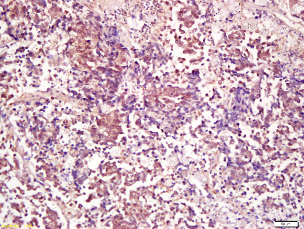 PP2A alpha/beta Antibody in Immunohistochemistry (Paraffin) (IHC (P))