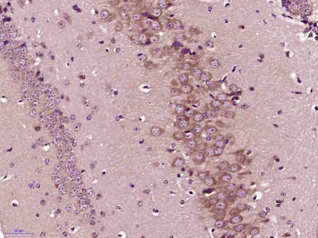 PP2A alpha/beta Antibody in Immunohistochemistry (Paraffin) (IHC (P))