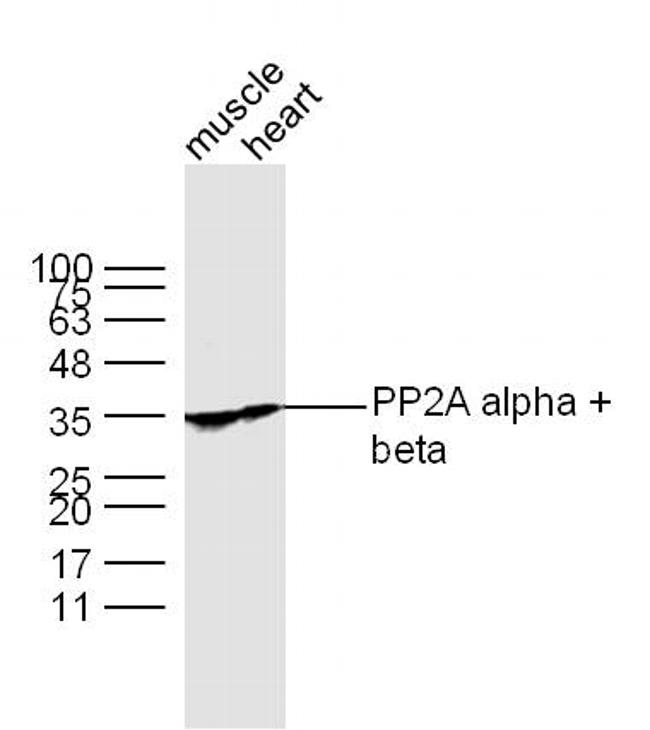 PP2A alpha/beta Antibody in Western Blot (WB)