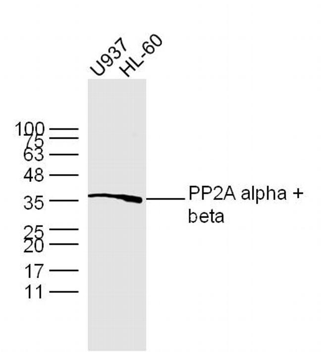 PP2A alpha/beta Antibody in Western Blot (WB)