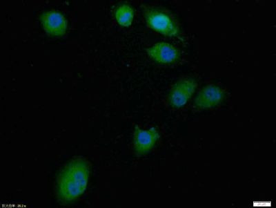 Bcl-2 Antibody in Immunocytochemistry (ICC/IF)