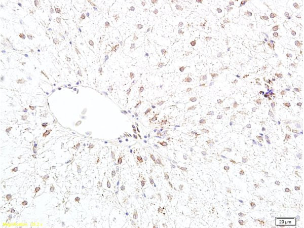 Bcl-2 Antibody in Immunohistochemistry (Paraffin) (IHC (P))