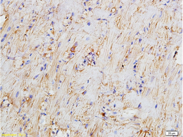 Bcl-2 Antibody in Immunohistochemistry (Paraffin) (IHC (P))