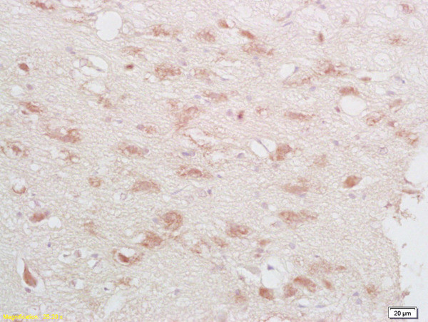 Phospho-CREB-1 (Ser133) Antibody in Immunohistochemistry (Paraffin) (IHC (P))