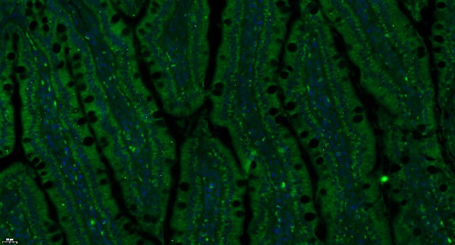 Insulin Receptor alpha Antibody in Immunohistochemistry (Paraffin) (IHC (P))