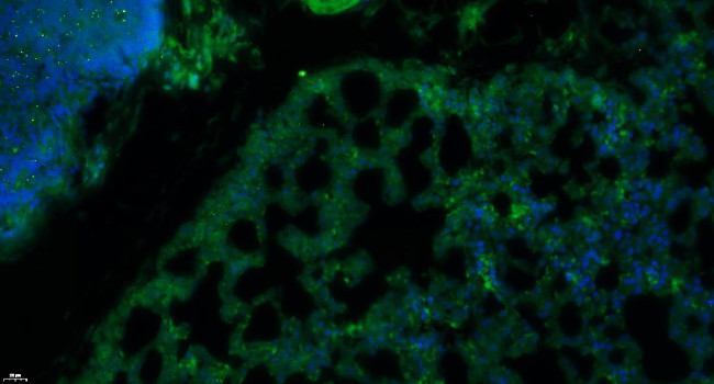 Insulin Receptor alpha Antibody in Immunohistochemistry (Paraffin) (IHC (P))