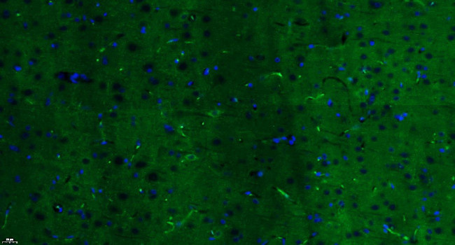 Insulin Receptor alpha Antibody in Immunohistochemistry (Paraffin) (IHC (P))