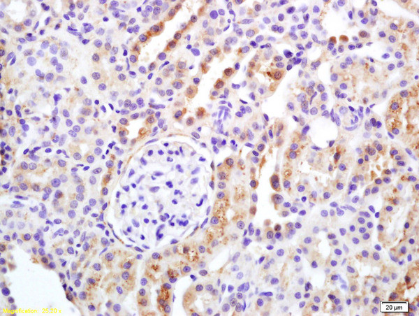 APAF1CT Antibody in Immunohistochemistry (Paraffin) (IHC (P))