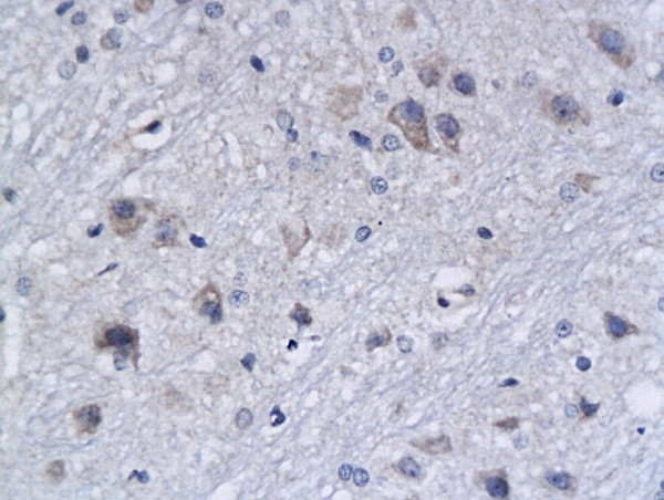 APAF1NT Antibody in Immunohistochemistry (Paraffin) (IHC (P))