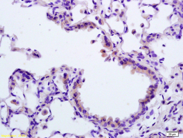 APAF1NT Antibody in Immunohistochemistry (Paraffin) (IHC (P))