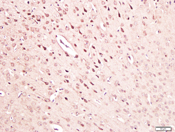 NGF beta Antibody in Immunohistochemistry (Paraffin) (IHC (P))