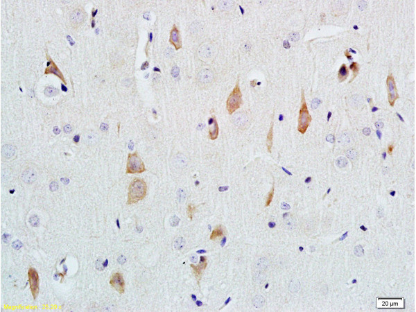 NGF beta Antibody in Immunohistochemistry (Paraffin) (IHC (P))