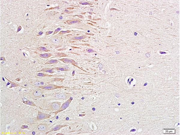 Neuropeptide Y Antibody in Immunohistochemistry (Paraffin) (IHC (P))