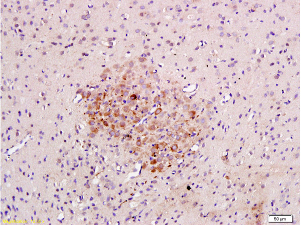 Caspase-3 Antibody in Immunohistochemistry (Paraffin) (IHC (P))