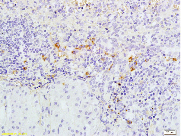 Caspase-3 Antibody in Immunohistochemistry (Paraffin) (IHC (P))