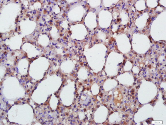 TGF beta 1 Antibody in Immunohistochemistry (Paraffin) (IHC (P))