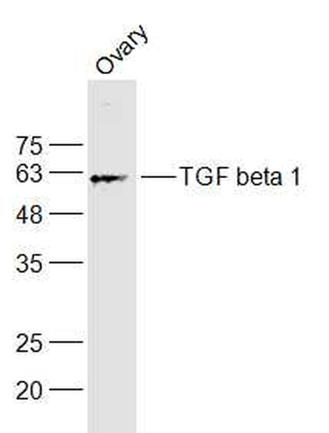 TGF beta 1 Antibody in Western Blot (WB)