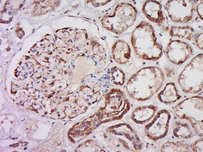 caspase-3 p12 subunit Antibody in Immunohistochemistry (Paraffin) (IHC (P))