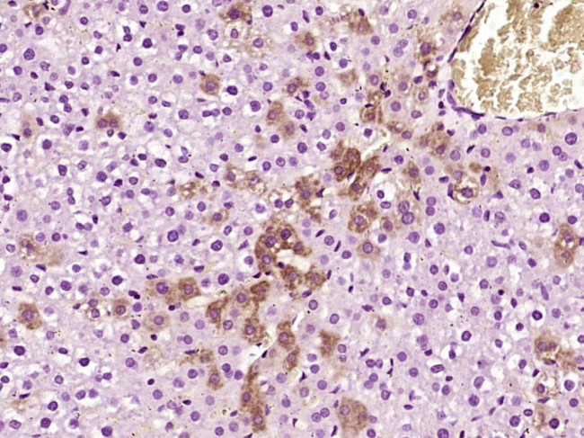 alpha 1 Antitrypsin Antibody in Immunohistochemistry (Paraffin) (IHC (P))