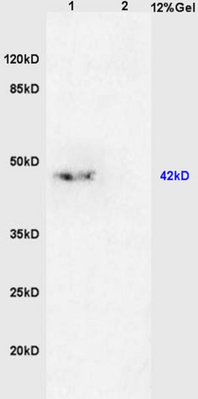 TGF beta 2 Propeptide Antibody in Western Blot (WB)