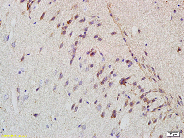 Amyloid Precursor Protein Antibody in Immunohistochemistry (Paraffin) (IHC (P))