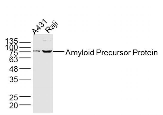 Amyloid Precursor Protein Antibody in Western Blot (WB)