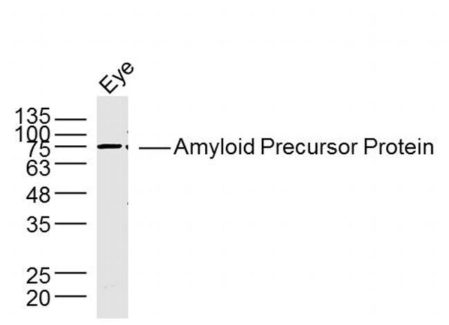 Amyloid Precursor Protein Antibody in Western Blot (WB)