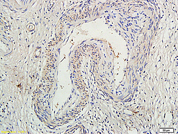 SOCS1 Antibody in Immunohistochemistry (Paraffin) (IHC (P))