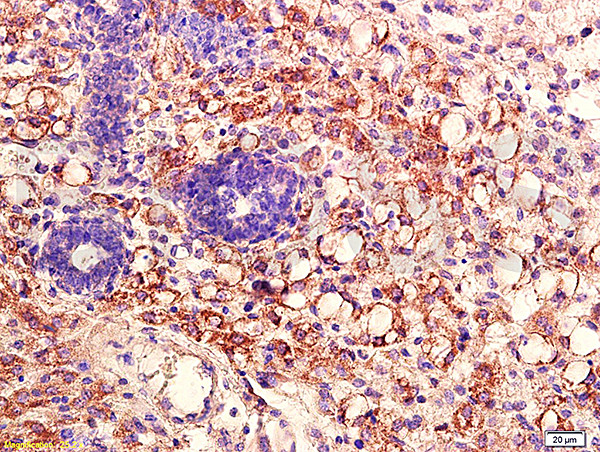 AKT1/2/3 Antibody in Immunohistochemistry (Paraffin) (IHC (P))