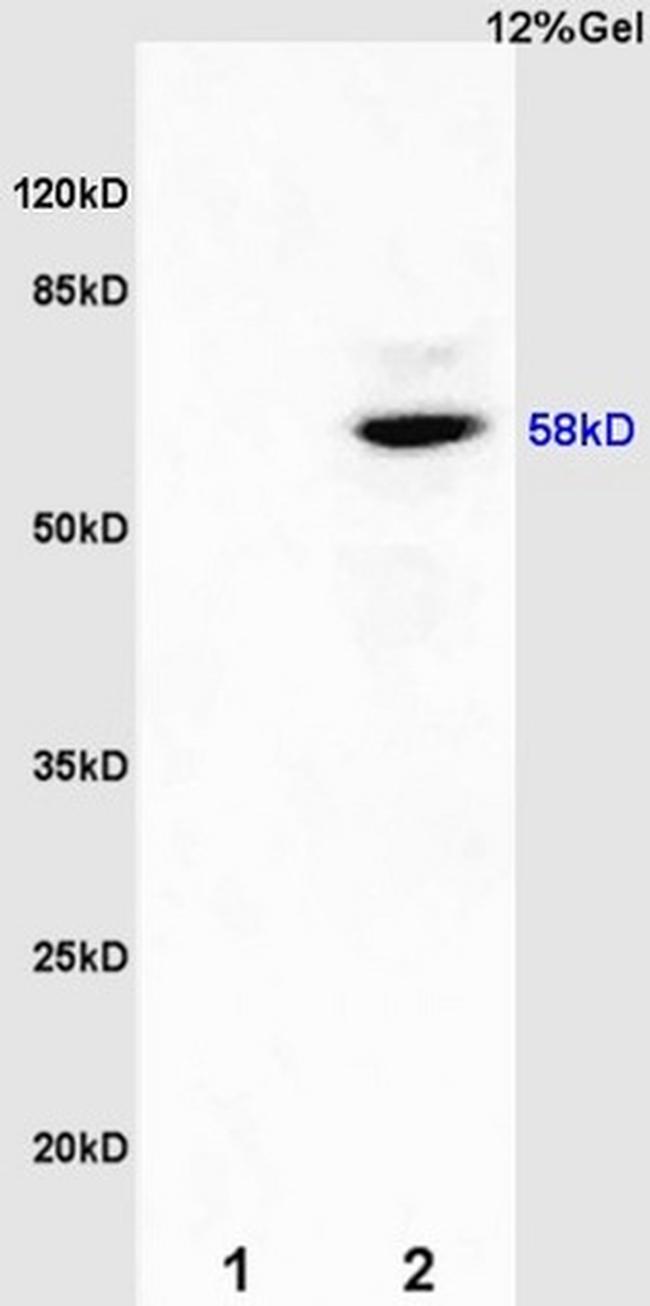 Estrogen receptor beta Antibody in Western Blot (WB)