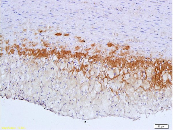 TGF beta Receptor 2 Antibody in Immunohistochemistry (Paraffin) (IHC (P))