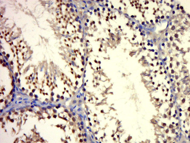 Androgen receptor Antibody in Immunohistochemistry (Paraffin) (IHC (P))